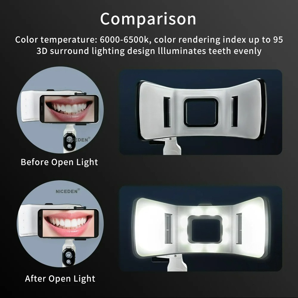Tandheelkundige fotografie lic - Photography Lighting Accessories recensie en prijs