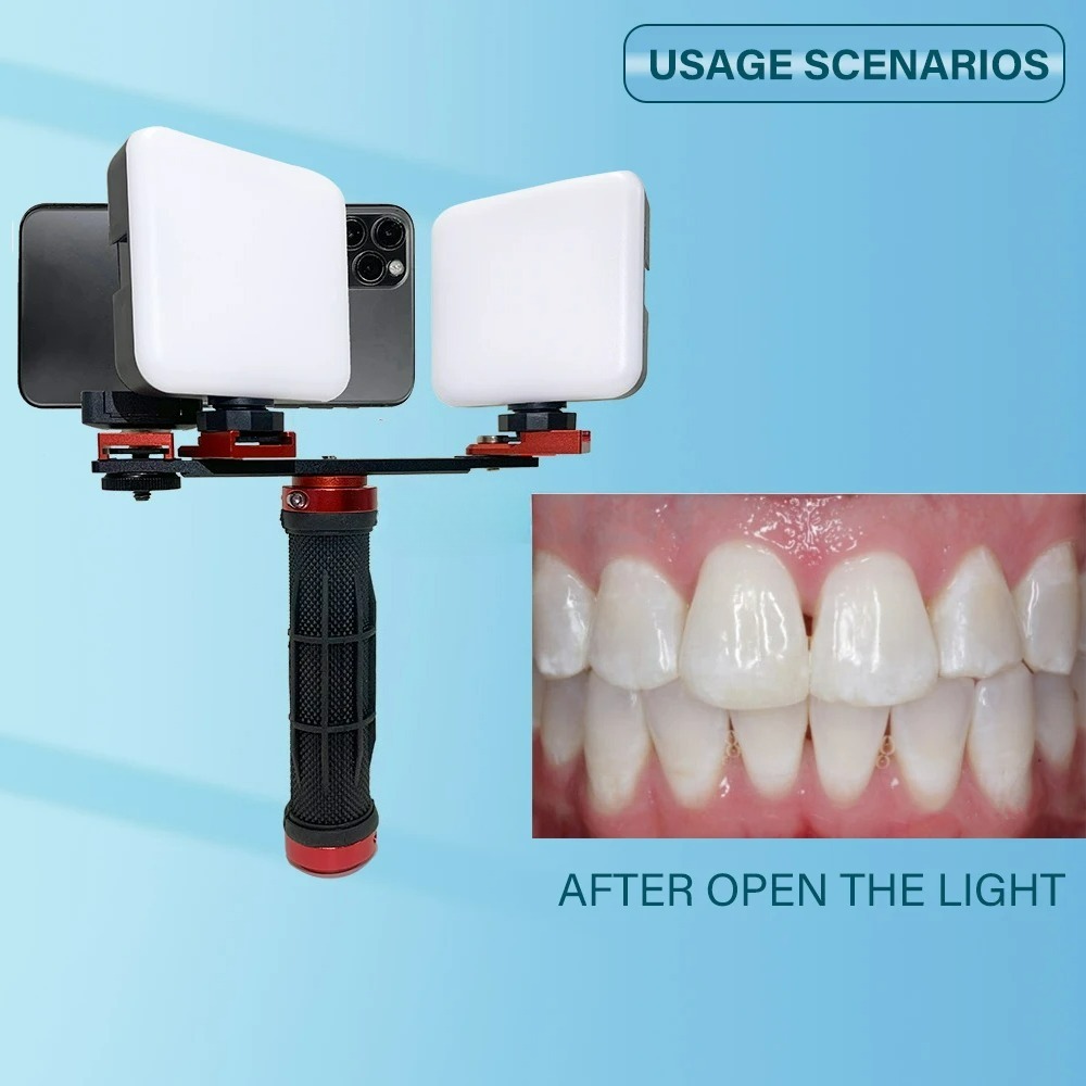 Tandheelkundige fotografie lic - Photography Lighting Accessories recensie en prijs
